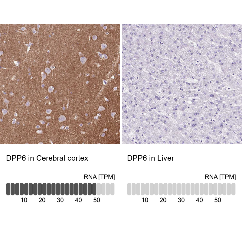 Anti-DPP6 Antibody