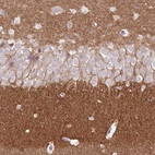 Immunohistochemical staining of human hippocampus shows strong positivity in neuropil.
