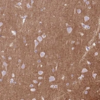 Immunohistochemical staining of human cerebral cortex shows strong cytoplasmic positivity in neuropil.