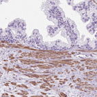 Immunohistochemical staining of human prostate shows moderate cytoplasmic positivity in smooth muscle cells.