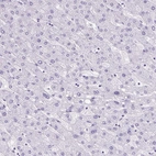 Immunohistochemical staining of human liver shows no positivity in hepatocytes as expected.