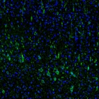 Immunofluorescence staining of mouse cerebral cortex shows strong positivity in a subset of neurons in the somatosensory cortex.