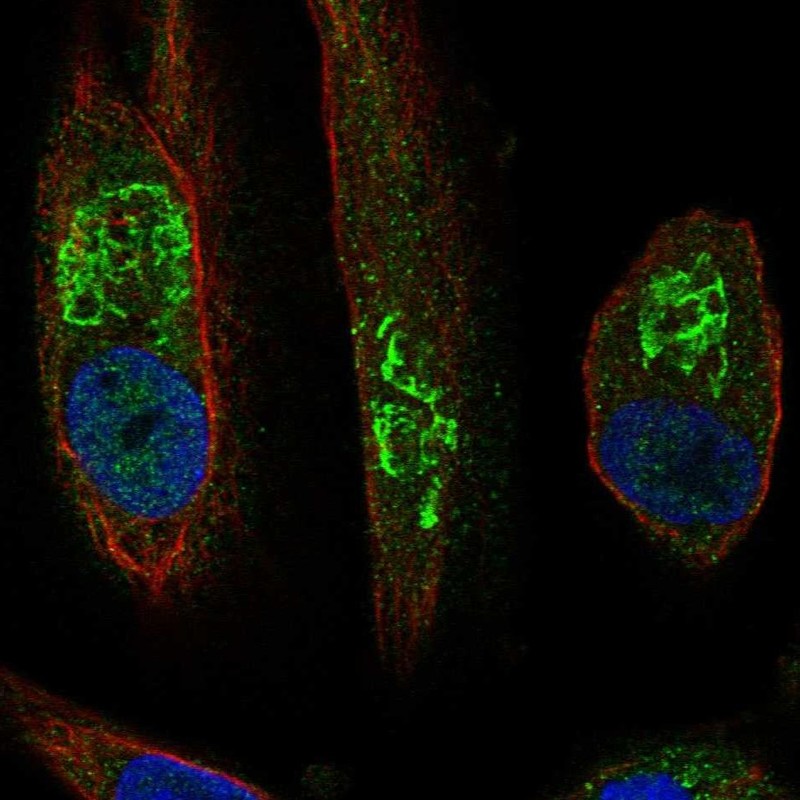 Anti-SLC17A1 Antibody