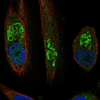 Anti-SLC17A1 Antibody