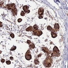 Immunohistochemical staining of human Breast shows strong membranous and cytoplasmic positivity in glandular cells.