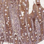 Immunohistochemical staining of human Duodenum shows moderate cytoplasmic and membranous positivity in glandular cells.