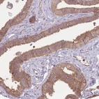 Immunohistochemical staining of human Fallopian tube shows moderate membranous and cytoplasmic positivity in glandular cells.