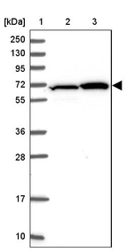 Lane 1: Marker [kDa] 250, 130, 95, 72, 55, 36, 28, 17, 10_br/_Lane 2: Human cell line RT-4_br/_Lane 3: Human cell line U-251MG sp