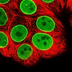 Immunofluorescent staining of human cell line MCF7 shows localization to nucleoplasm & nuclear membrane.