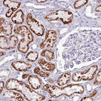 Anti-HSD3B7 Antibody