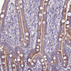 Immunohistochemical staining of human duodenum shows moderate granular cytoplasmic positivity in glandular cells.