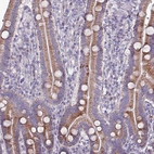 Immunohistochemical staining of human duodenum shows moderate granular cytoplasmic positivity in glandular cells.