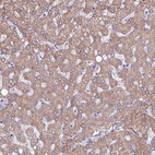 Immunohistochemical staining of human liver shows moderate cytoplasmic positivity in hepatocytes.