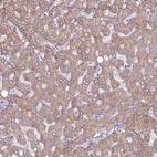 Immunohistochemical staining of human liver shows moderate cytoplasmic positivity in hepatocytes.