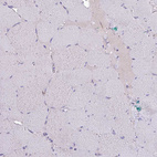 Immunohistochemical staining of human skeletal muscle shows no positivity in myocytes as expected.