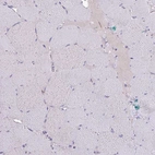 Immunohistochemical staining of human skeletal muscle shows no positivity in myocytes as expected.