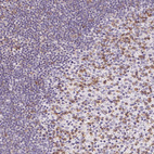 Anti-CD69 Antibody
