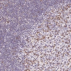 Immunohistochemical staining of human tonsil shows moderate membranous positivity mainly in germinal center cells.