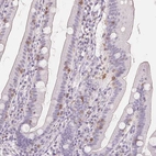 Immunohistochemical staining of human duodenum shows moderate membranous positivity in a subset of lymphoid cells.
