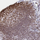 Immunohistochemical staining of human lymph node shows moderate to strong positivity in nuclear membrane in non-germinal center cells.