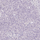 Immunohistochemical staining of human pancreas shows no positivity in exocrine and endocrine glandular cells as expected.