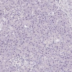 Immunohistochemical staining of human pancreas shows no positivity in exocrine and endocrine glandular cells as expected.