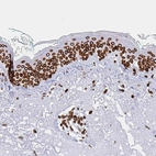 Immunohistochemical staining of human skin shows moderate to strong positivity in nuclear membrane in keratinocytes.