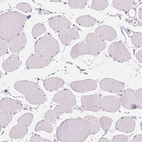 Immunohistochemical staining of human skeletal muscle shows no membranous positivity in myocytes as expected.