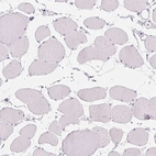 Immunohistochemical staining of human skeletal muscle shows no membranous positivity in myocytes as expected.