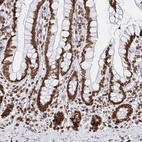 Immunohistochemical staining of human small intestine shows moderate to strong positivity in nuclear membrane in glandular cells.