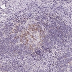 Immunohistochemical staining of human lymph node shows moderate membranous positivity in germinal center cells.