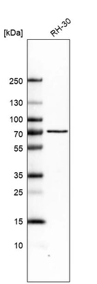 Western blot analysis in human cell line RH-30.