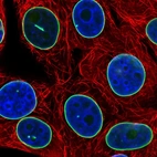 Immunofluorescent staining of human cell line MCF7 shows localization to nuclear membrane.