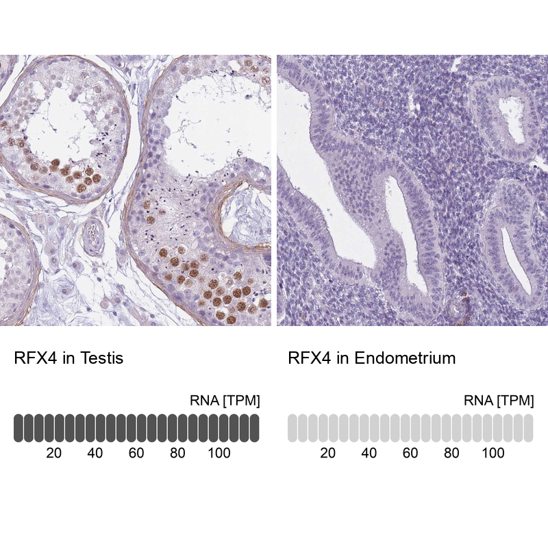 Anti-RFX4 Antibody