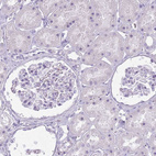 Immunohistochemical staining of human kidney shows no positivity in cells in tubules as expected.