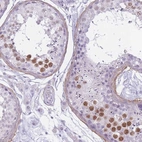 Immunohistochemical staining of human testis shows moderate nuclear positivity in cells in seminiferous ducts.