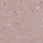 Immunohistochemical staining of human cerebral cortex shows moderate cytoplasmic positivity in neuropil.