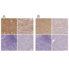 Immunohistochemical staining of human cerebral cortex, heart muscle, lymphoid tissues and pancreas using Anti-CAP2 antibody HPA050530 (A) shows similar protein distribution across tissues to independent antibody HPA054147 (B).