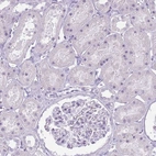 Immunohistochemical staining of human kidney shows no nuclear positivity in cells in tubules as expected.