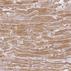 Immunohistochemical staining of human heart muscle shows strong cytoplasmic positivity in cardiomyocytes.