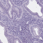 Immunohistochemical staining of human endometrium shows no positivity in glandular cells as expected.