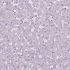Immunohistochemical staining of human liver shows no nuclear positivity in hepatocytes as expected.
