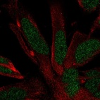 Immunofluorescent staining of human cell line AF22 shows localization to nucleus.