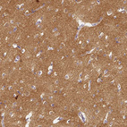 Immunohistochemical staining of human cerebral cortex shows strong cytoplasmic positivity in neuropil.
