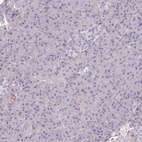 Immunohistochemical staining of human pancreas shows no positivity in exocrine glandular cells as expected.