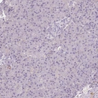 Immunohistochemical staining of human pancreas shows no positivity in exocrine glandular cells as expected.