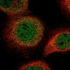 Immunofluorescent staining of human cell line A-431 shows localization to nucleoplasm & cytosol.