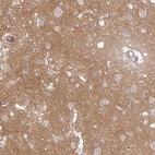 Immunohistochemical staining of human cerebral cortex shows high expression.
