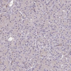 Immunohistochemical staining of human pancreas shows low expression as expected.