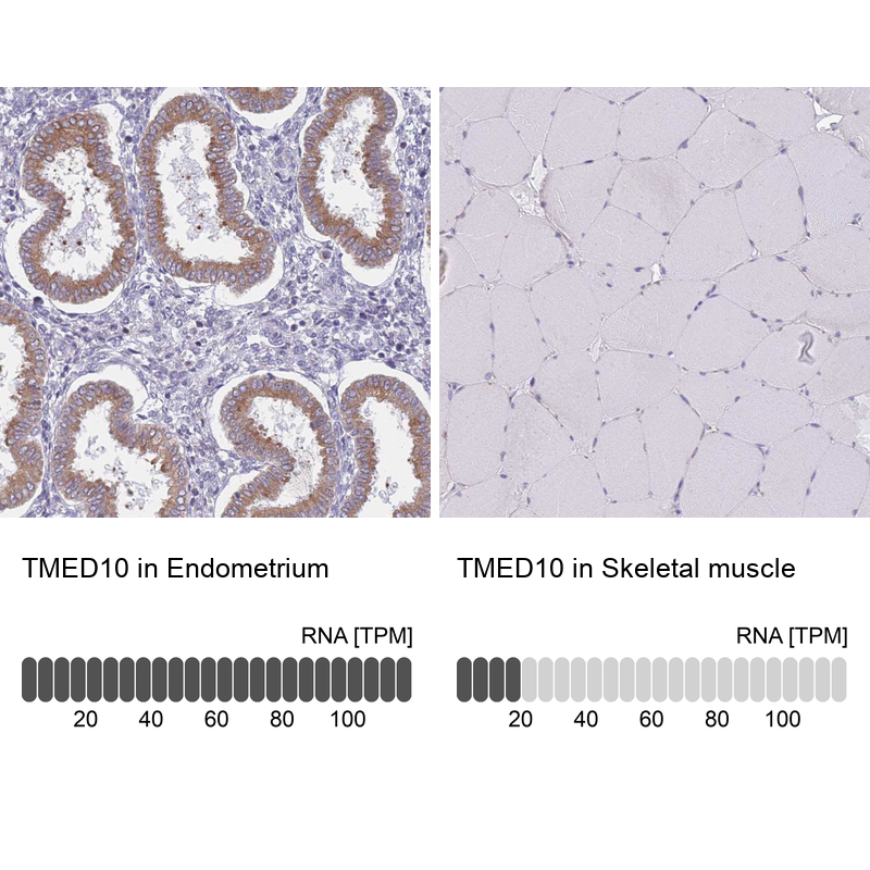 Anti-TMED10 Antibody